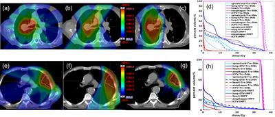 Dose rate and dose robustness for proton transmission FLASH-RT treatment in lung cancer